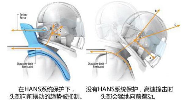 頭頸保護(hù)系統(tǒng)HANS，固定保護(hù)（更安全）